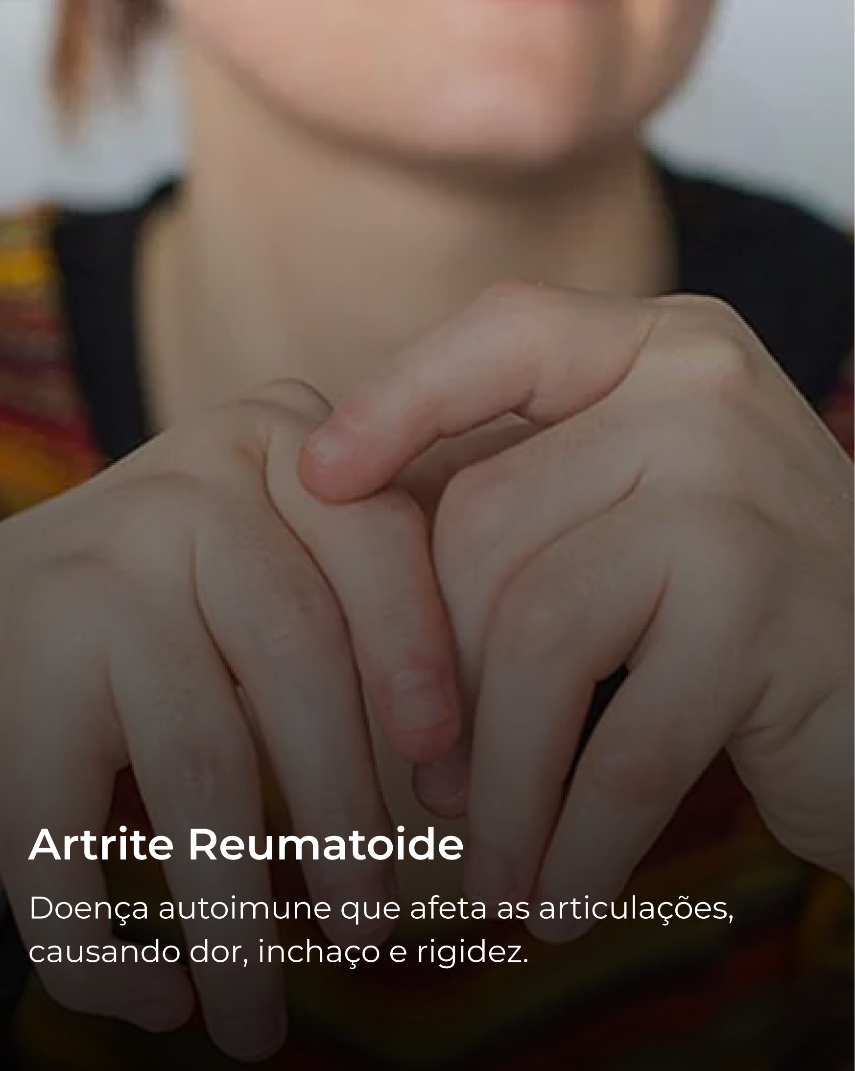 Artrite Reumatoide
