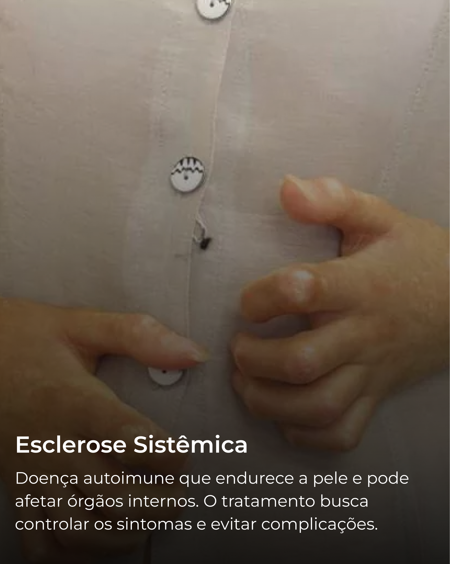 Esclerose Sistêmica