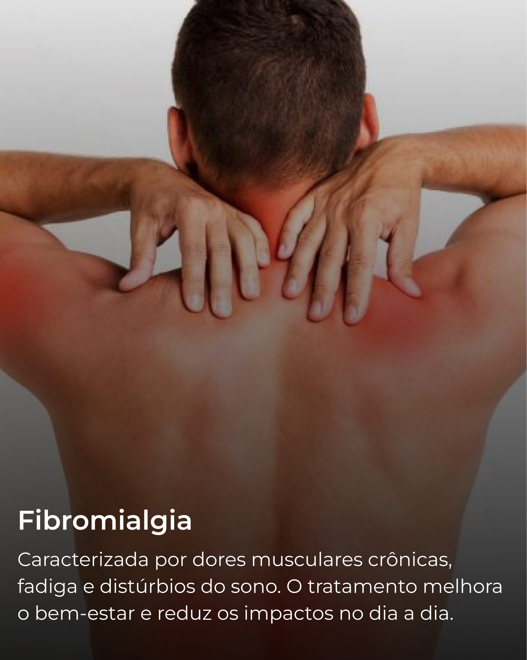Fibromialgia