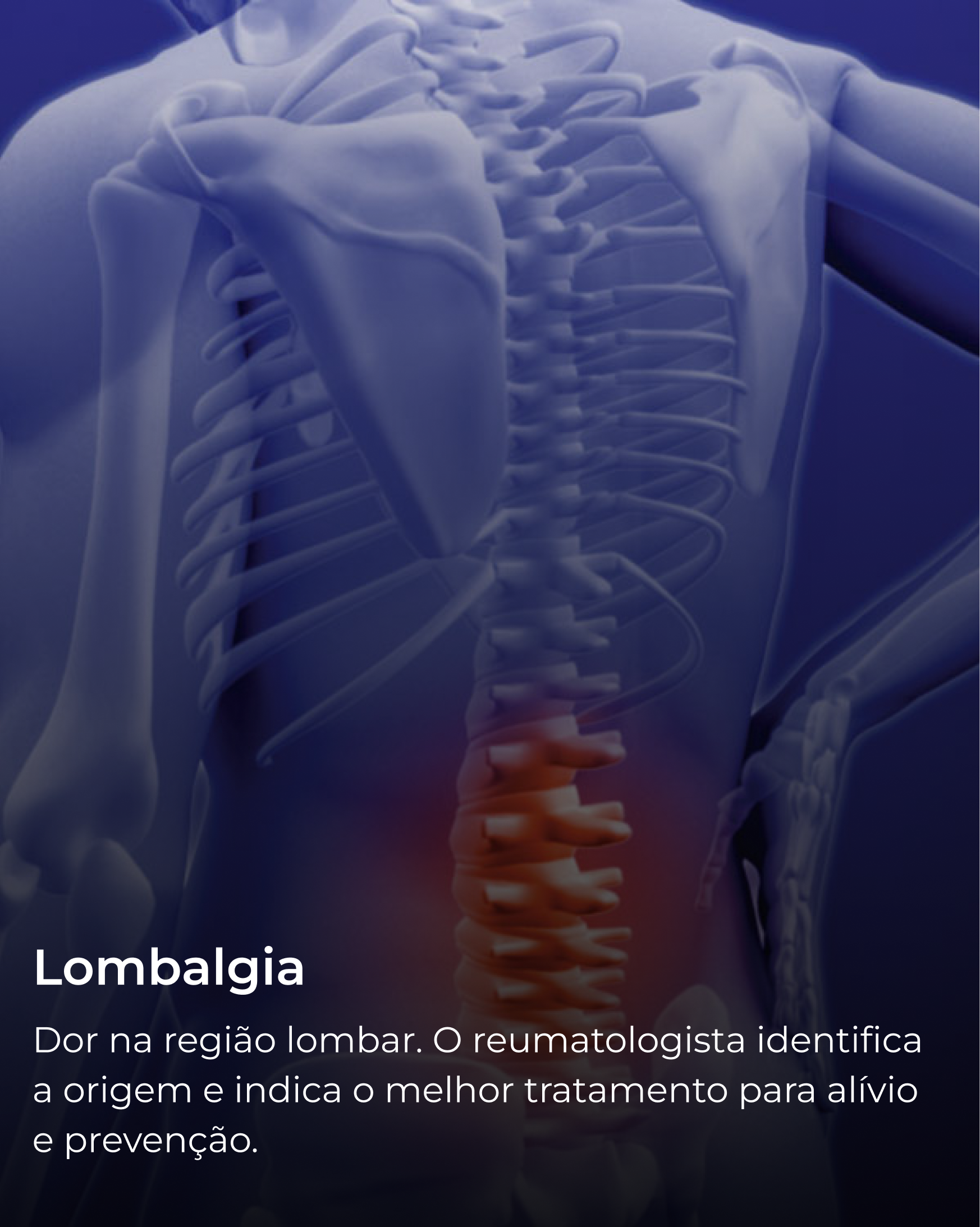 Lombalgia