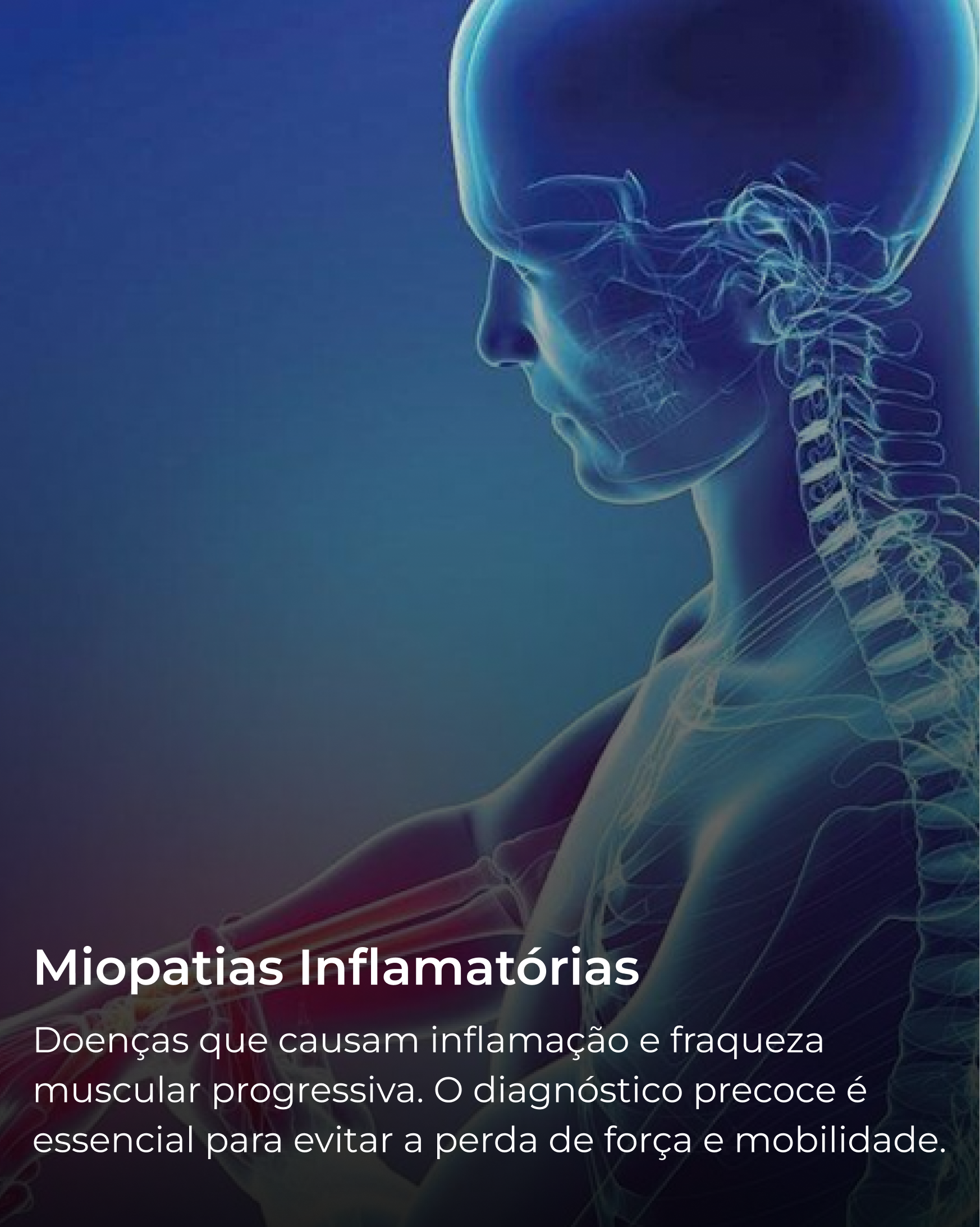 Miopatias Inflamatórias