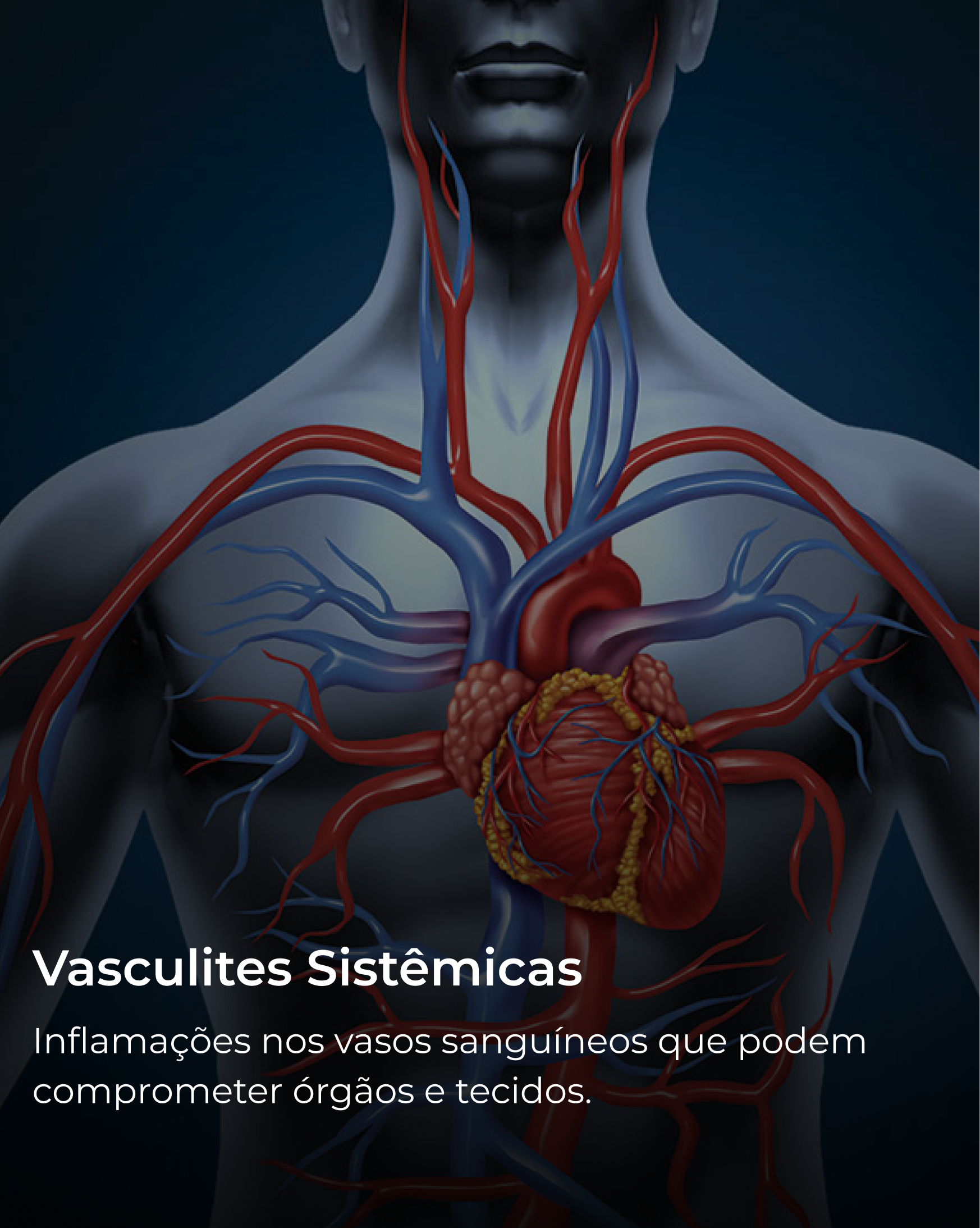 Vasculites Sistêmicas
